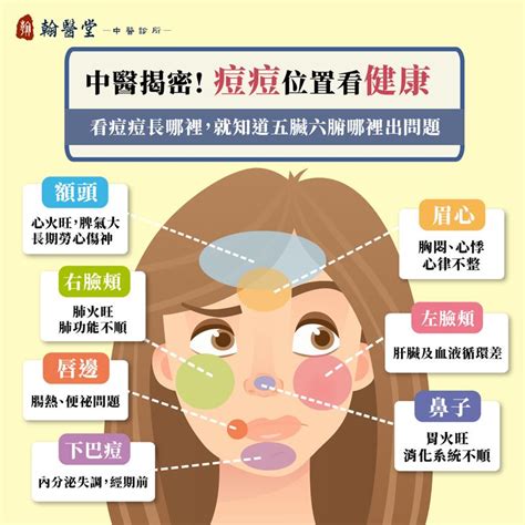 眉毛長痘痘面相|臉上痘痘影響運勢 8部位對應不同危機